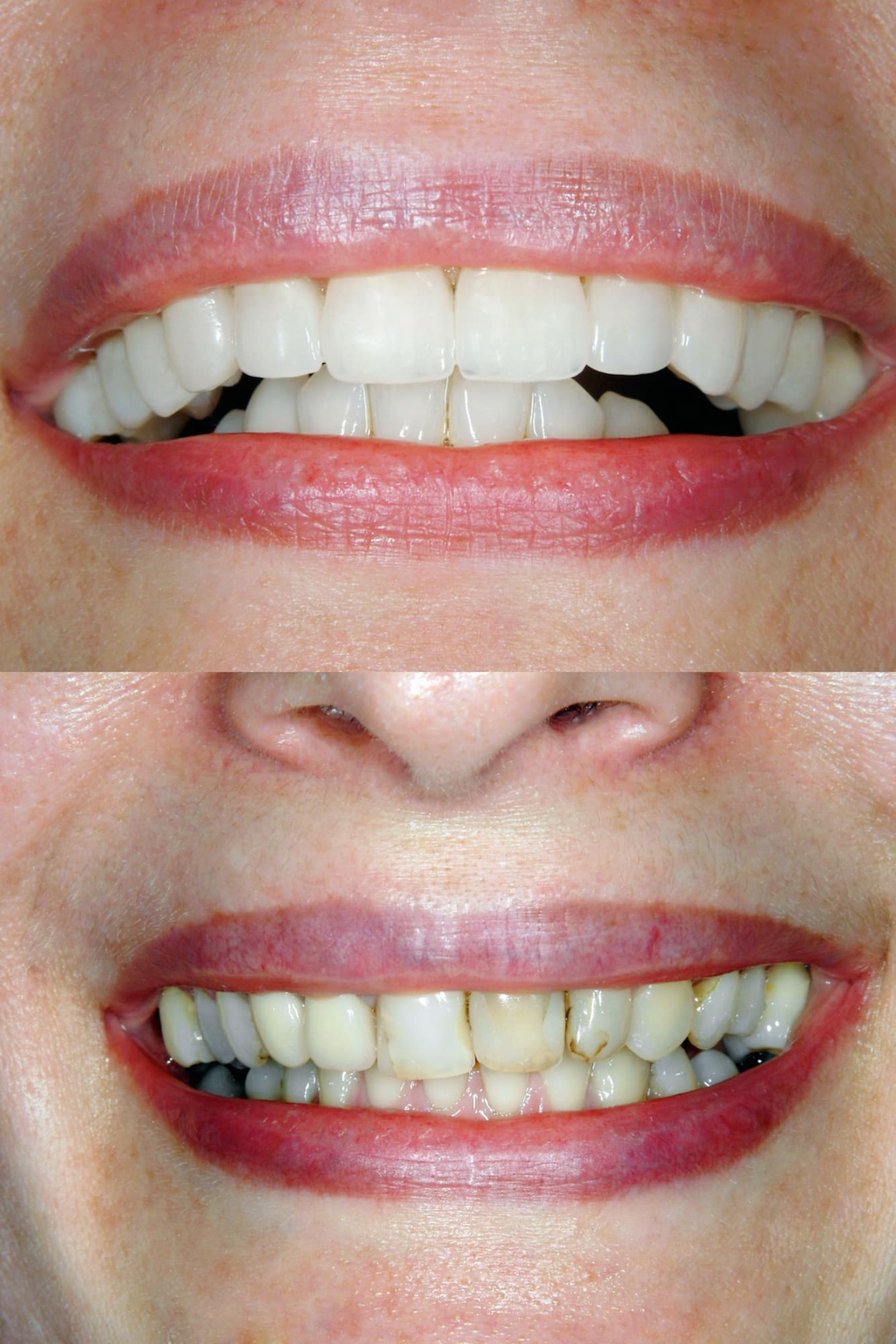 diseño de sonrisa nuevo ejemplo 2