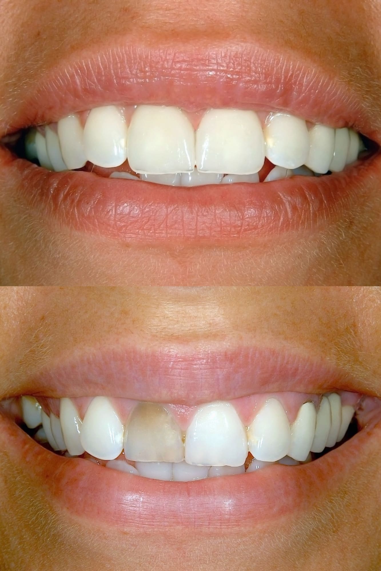 diseño de sonrisa nuevo ejemplo 3