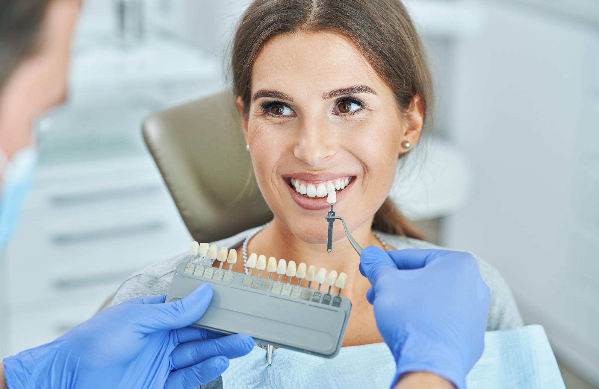 carillas dentales para mejorar la estética dental corrección dientes negros