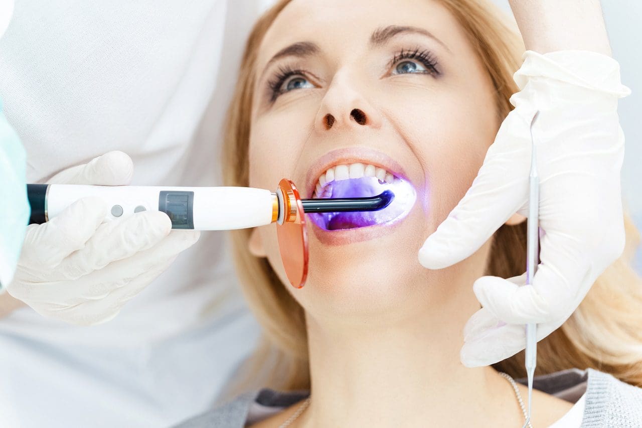 Paciente blanqueamiento de dientes en el dentista
