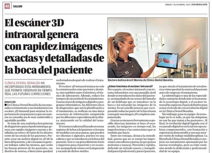 escaner 3d intraoral