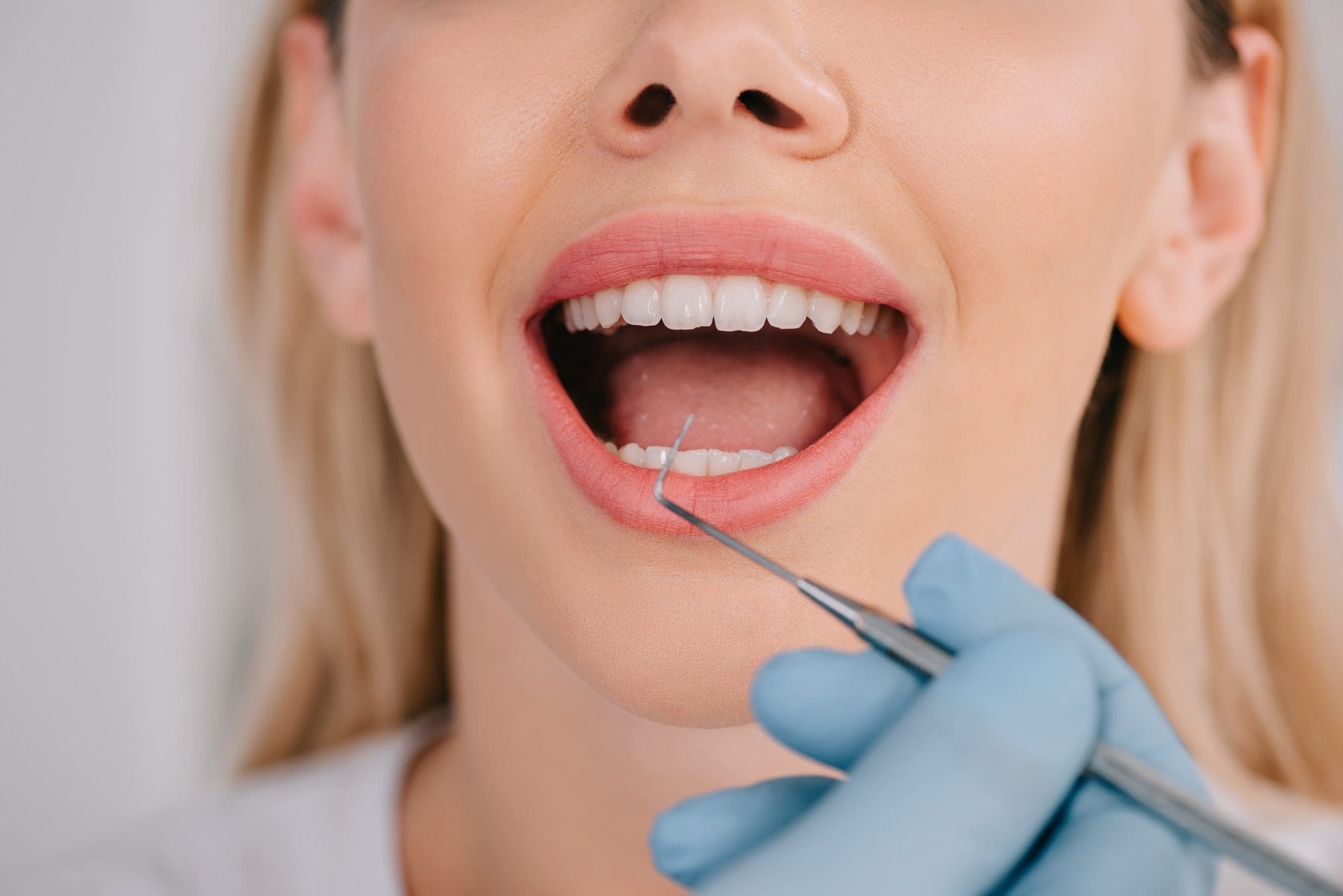 limpieza bucal - problemas dentales mas comunes
