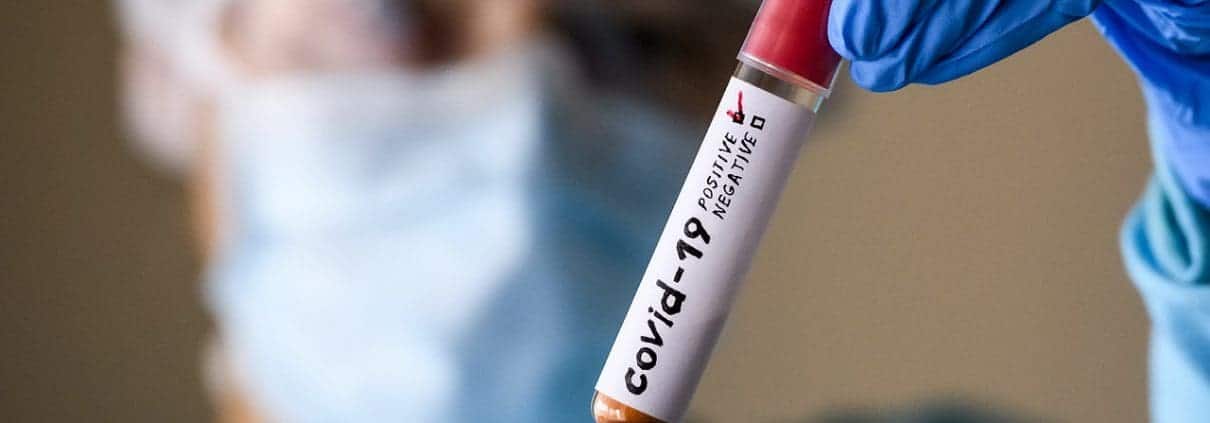 Como prevenir el contagio de Coronavirus