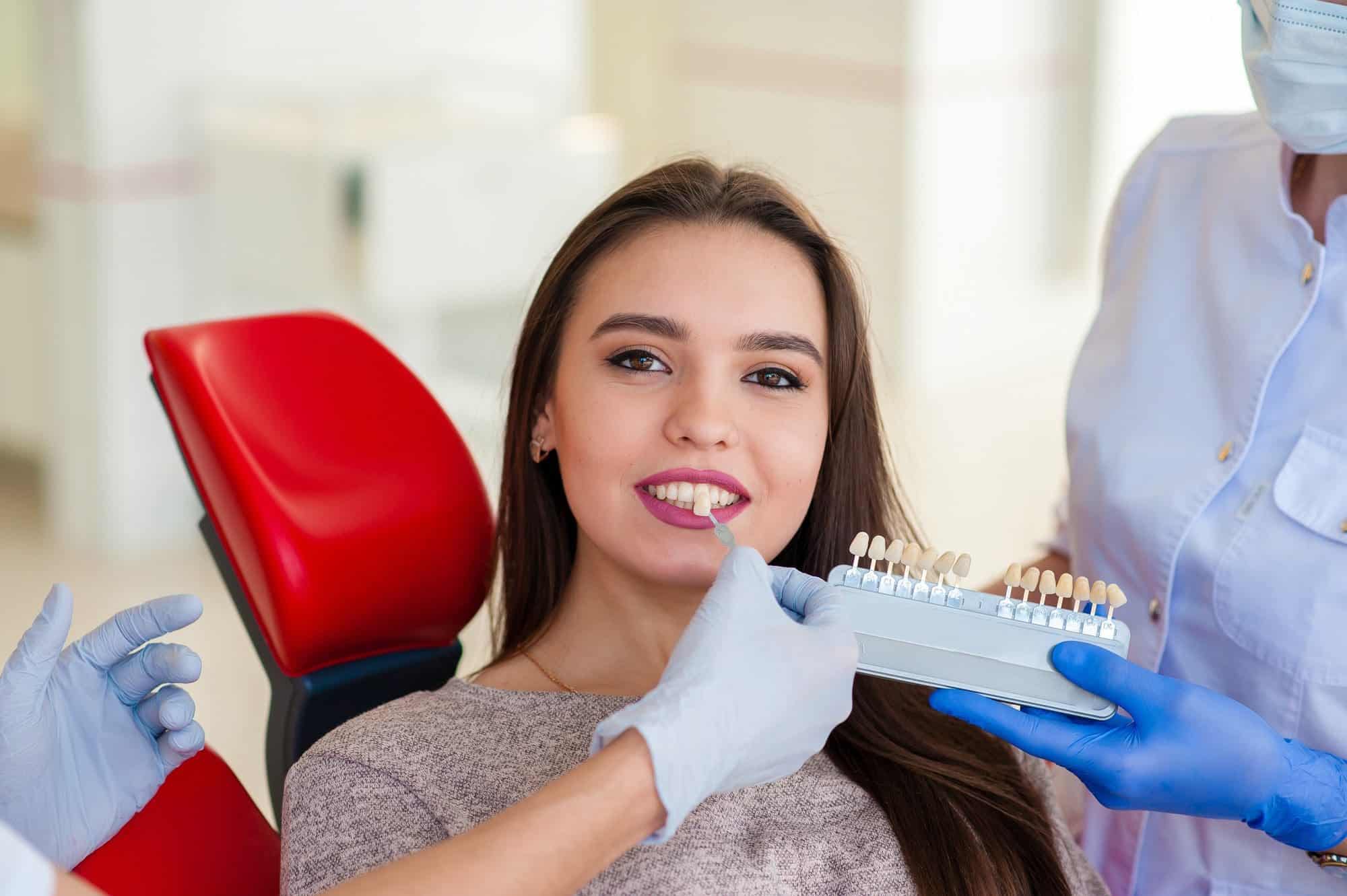carillas dentales en clínica dental ben alúa - famosos que usan carillas 
