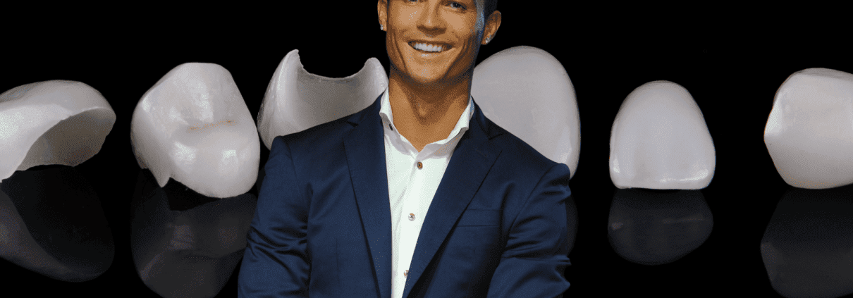 portada cristiano ronaldo - famosos que usan carillas