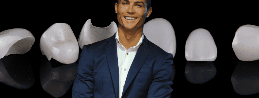 portada cristiano ronaldo - famosos que usan carillas