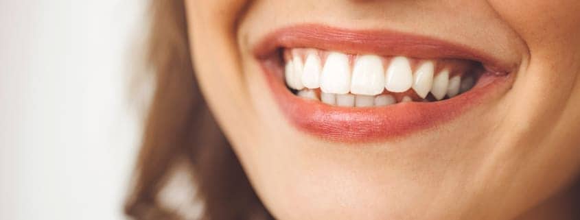 ¿Qué es el Diseño de Sonrisa? 22 diseño de sonrisa