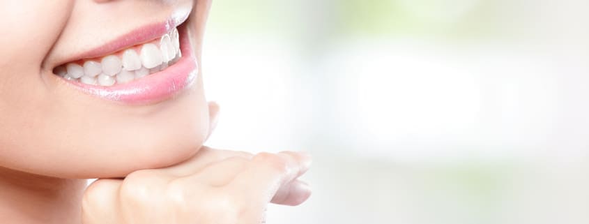 Diseño de sonrisa. Casos reales, antes y después 14 diseño de sonrisa en clinica dental Benalúa