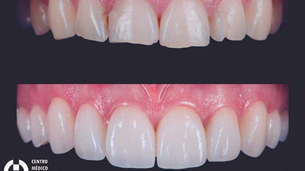 9a690491 33a6 44ce a158 2b77acd7415d 16 9 discover aspect ratio default 0 Clínica Dental Benalúa