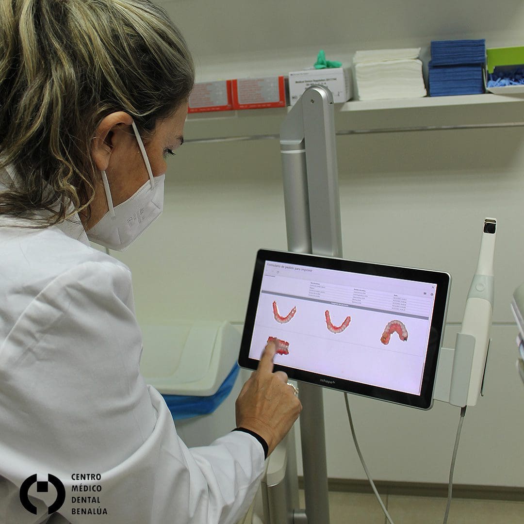 escaner en clinica dental benalua