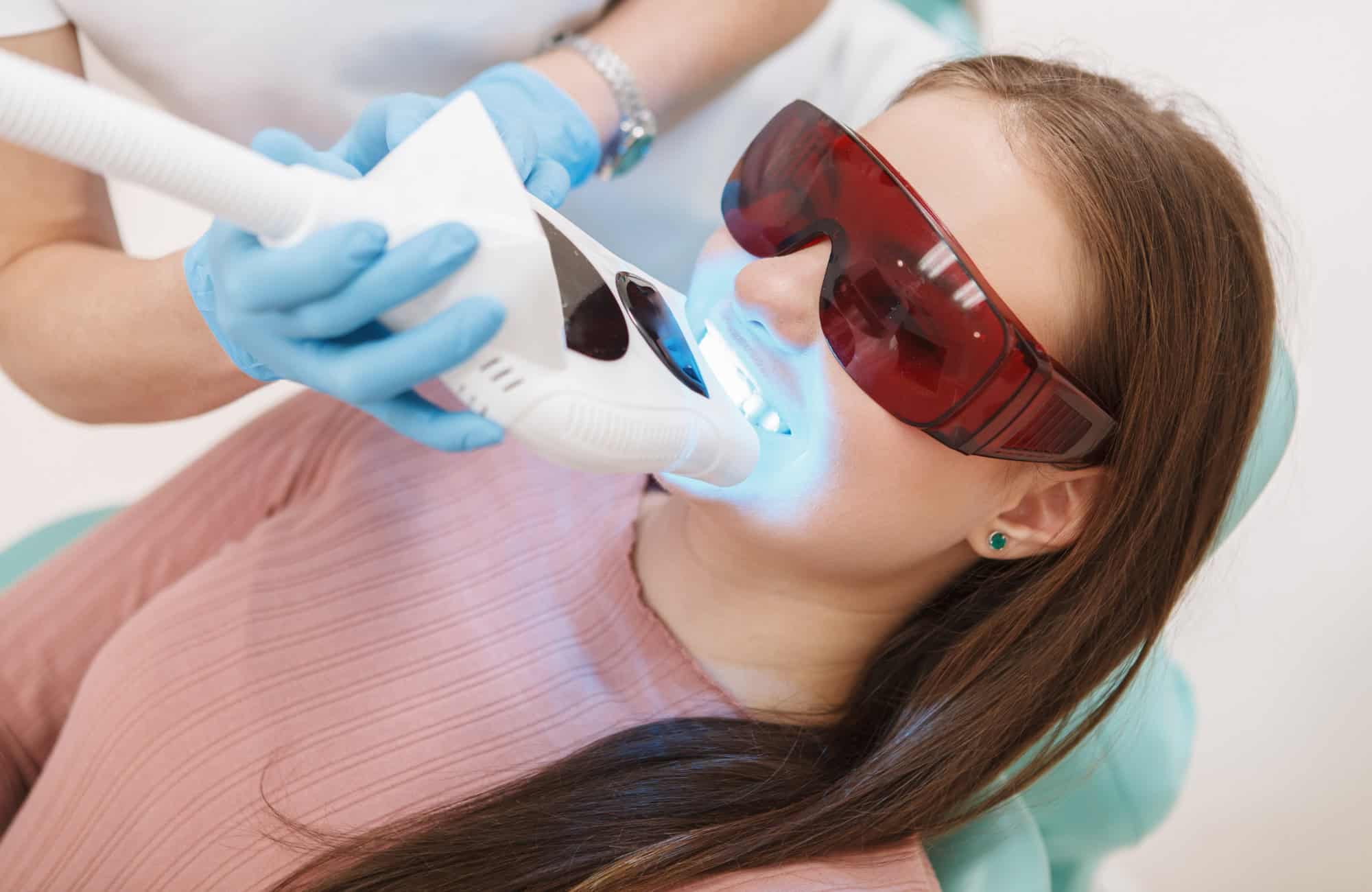 ¿Cómo Limpiar Dientes Amarillos? 16 Blanqueamiento Dental en Clínica
