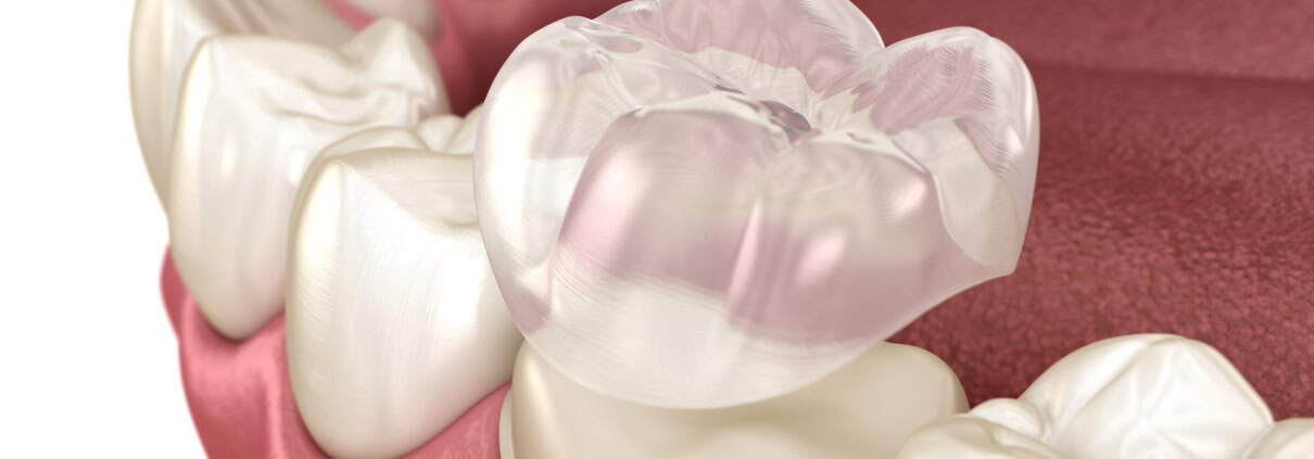 Materiales Biocompatibles: El Futuro de la Odontología 1 Materiales Biocompatibles en Odontología