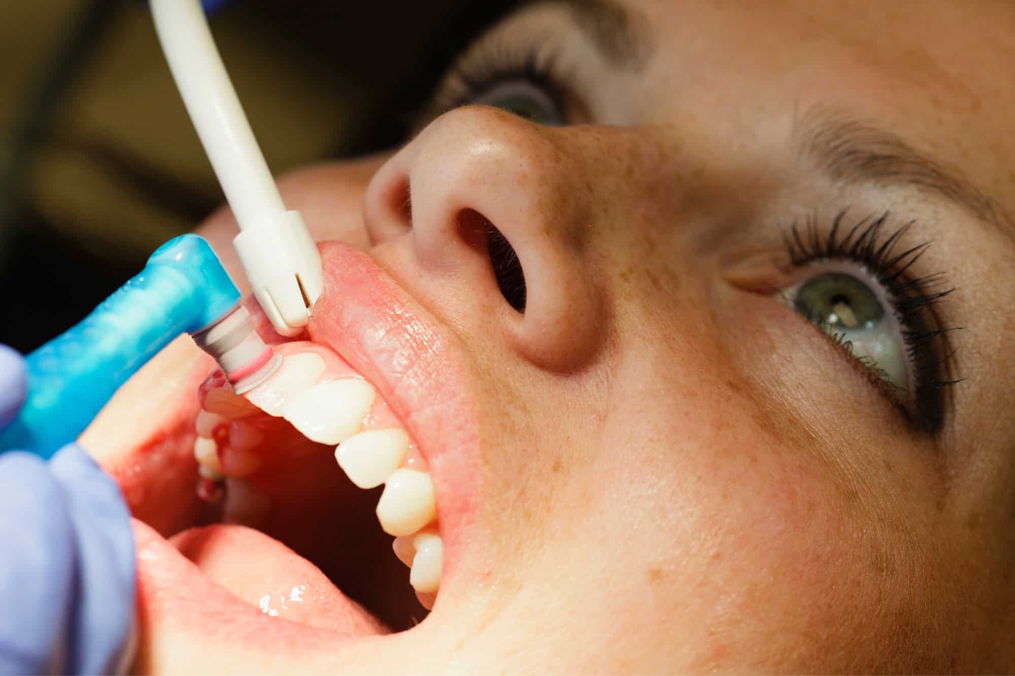 ¿Cómo influye la salud dental en tu bienestar general? 8 Importancia de una buena higiene bucal para el bienestar general
