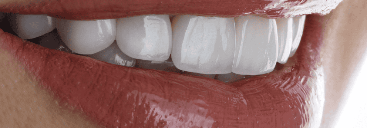 Tendencias en odontología cosmética