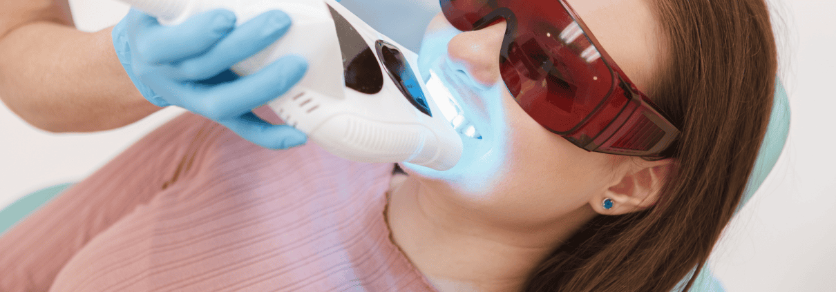La Importancia del Blanqueamiento Dental Profesional frente a los Métodos Caseros 1 blanqueamiento dental profesional