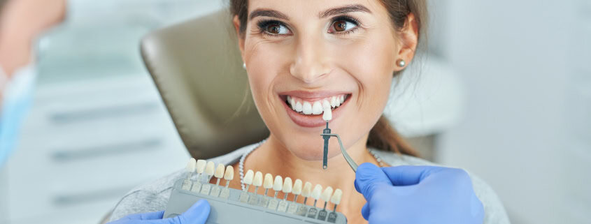 Paciente sonriendo junto a una guía de color dental durante el diseño de carillas dentales en Clínica Dental Benalúa Alicante