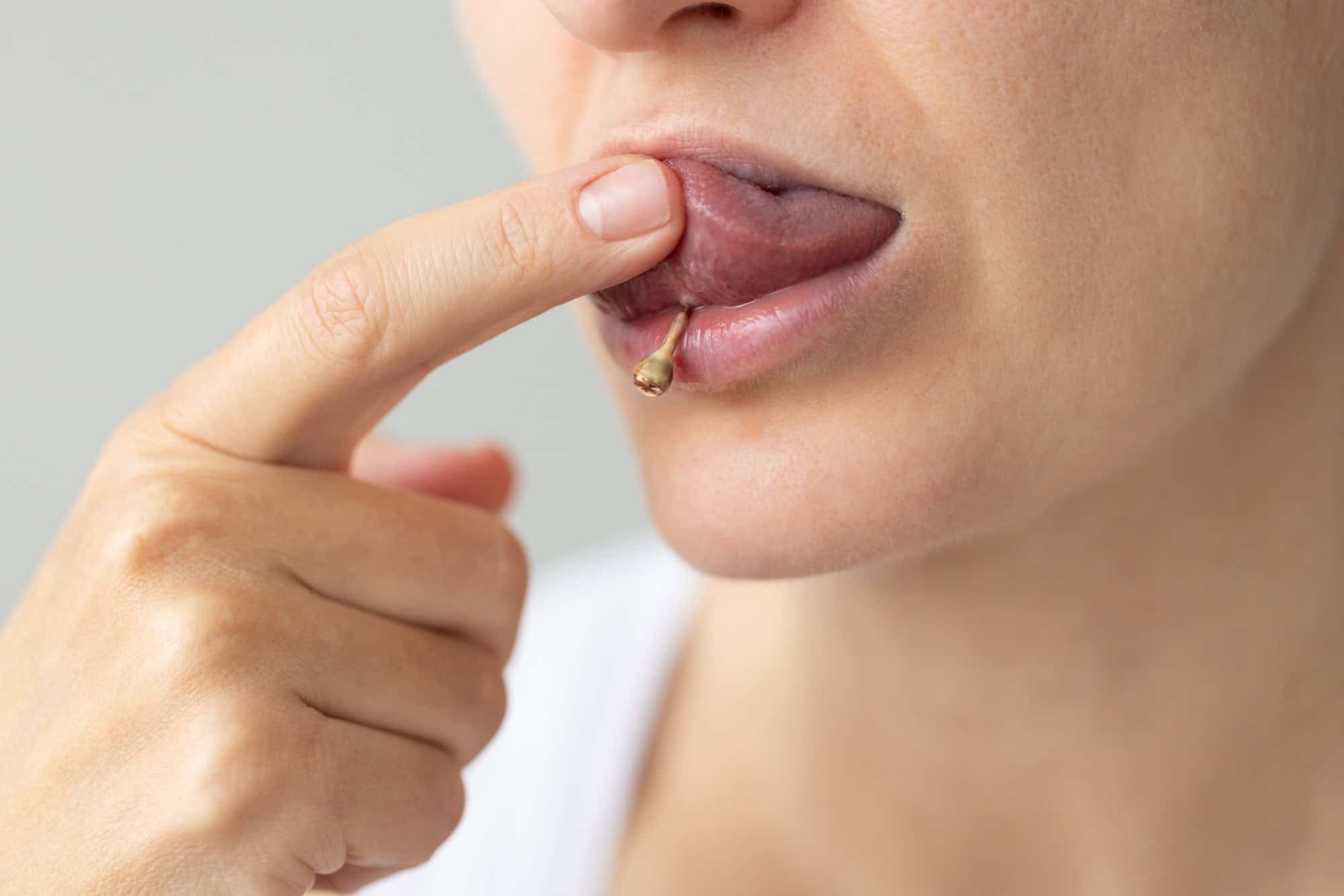 Mitos y verdades sobre el uso de piercings bucales 19 piercings en lengua