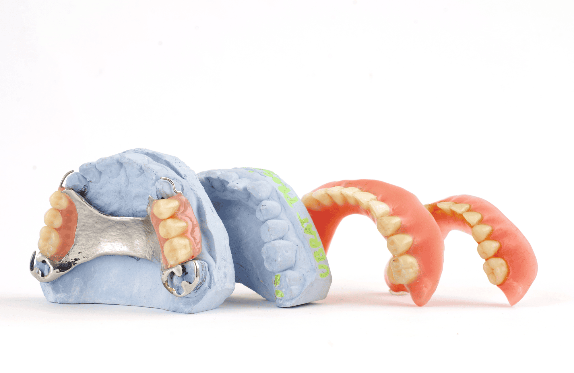 Dentaduras postizas vs. Implantes: ¿Cuál es la mejor opción? 5 dentadura postiza