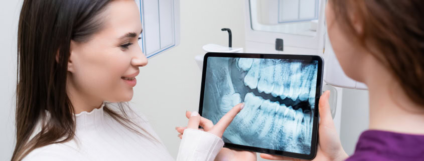 ¿Cómo elegir la mejor clínica dental en Alicante? Consejos que te ayudarán a decidir 13 cómo elegir clínica dental Alicante