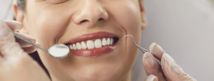 Top 5 tratamientos dentales más solicitados en Alicante 14 tratamientos dentales Alicante