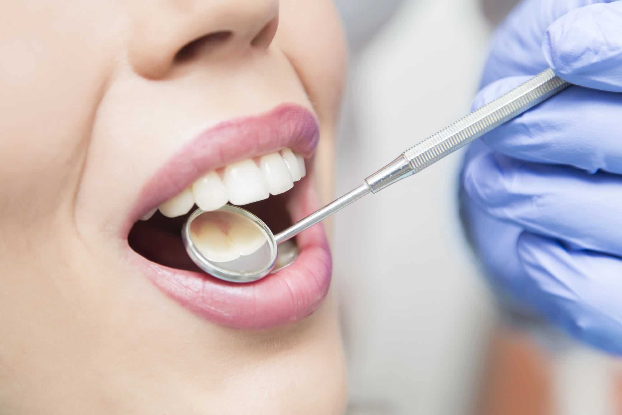 Top 5 tratamientos dentales más solicitados en Alicante 15 tratamientos dentales Alicante 2025