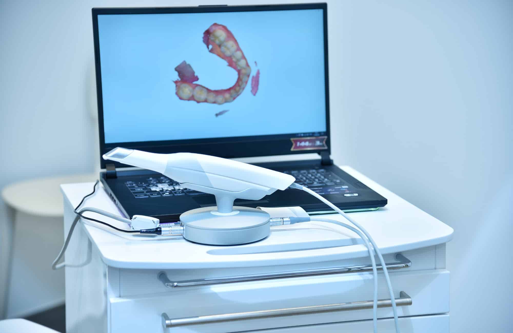 Implantología 3D: Revolucionando la Reposición Dental 6 clinica dental Benalúa 2025