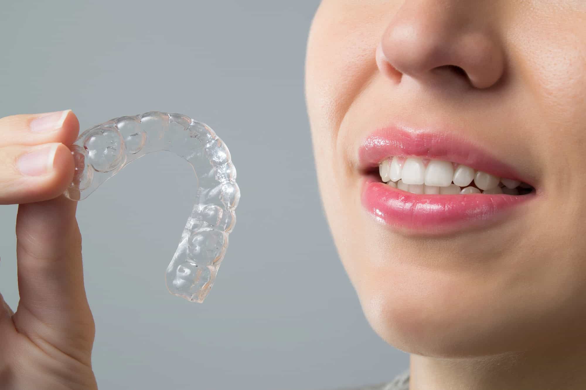 ortodoncia invisalign 2025