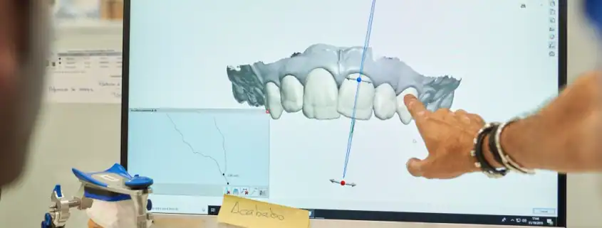 Guía Definitiva de Implantología 3D en Alicante: Innovaciones y Avances 1 implantología 3D alicante