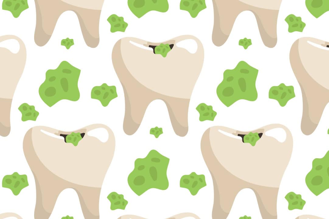 dientes verdes-1