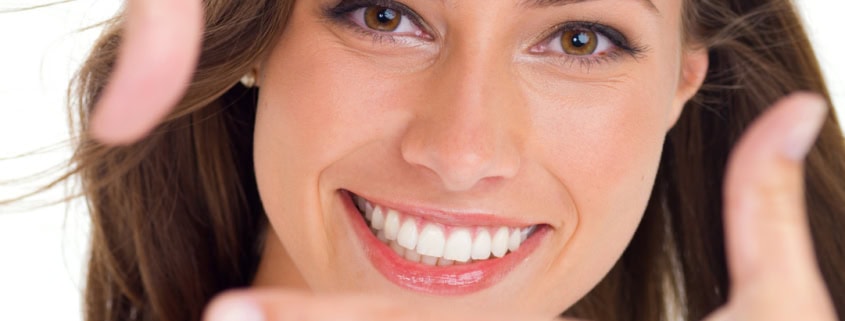 blanqueamiento dental - Blanqueamiento dental profesional: qué esperar y cuánto dura