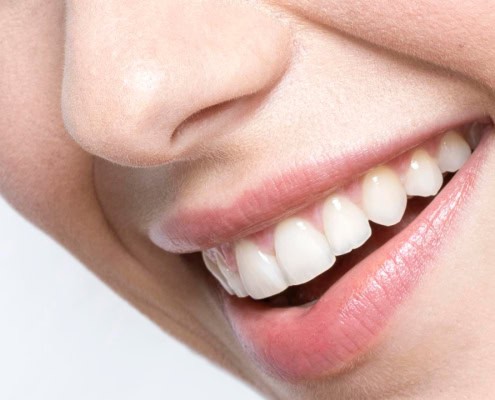 Primer plano de sonrisa tras blanqueamiento dental profesional en Clínica Dental Benalúa Alicante