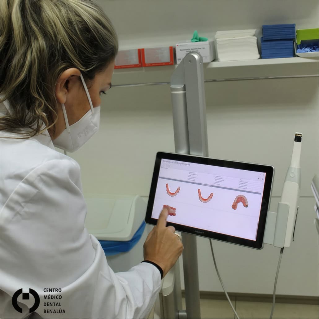 escaner en clinica dental benalua 450x450 LE upscale prime light ai 30