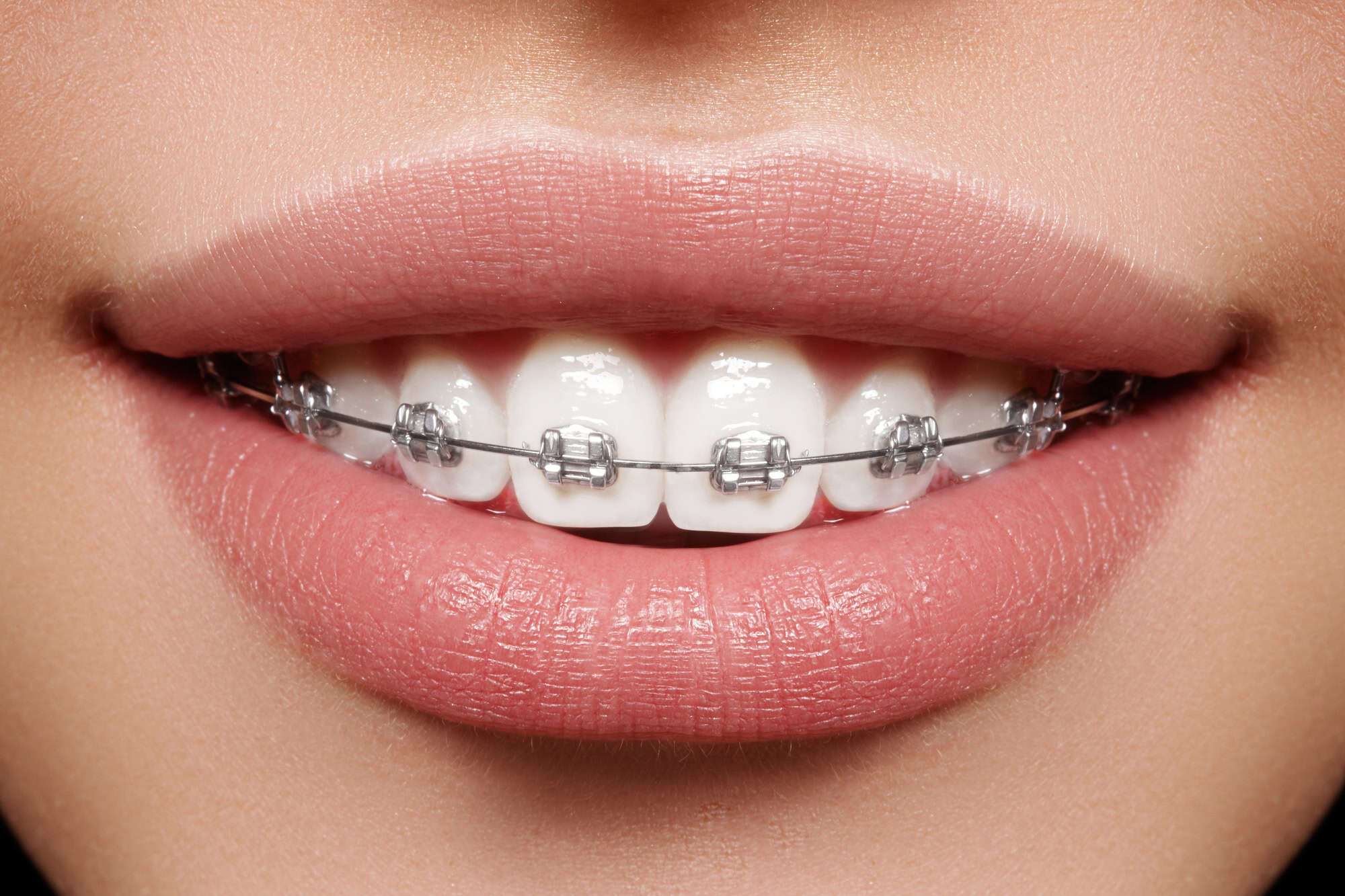 brackets