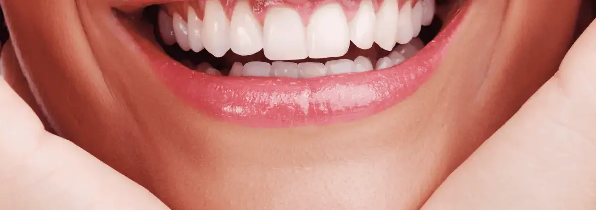 Sonrisa natural de una mujer con los dientes claros