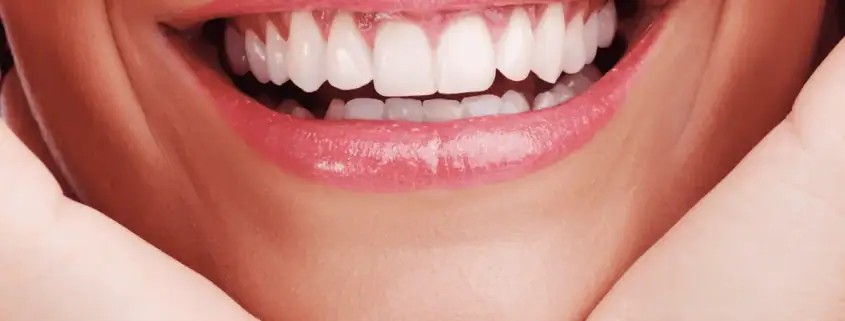 Sonrisa natural de una mujer con los dientes claros