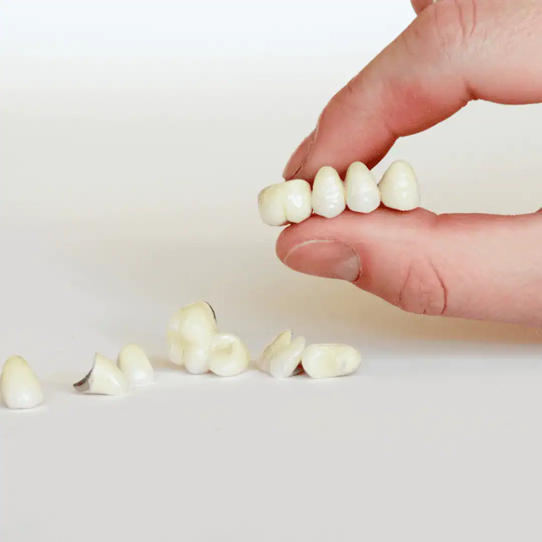 coronas de porcelana y coronas de zirconio