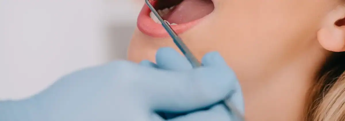 Bulto en el paladar: ¿qué puede ser? 1 Dentista revisando la boca y el paladar de una paciente con un espejo dental