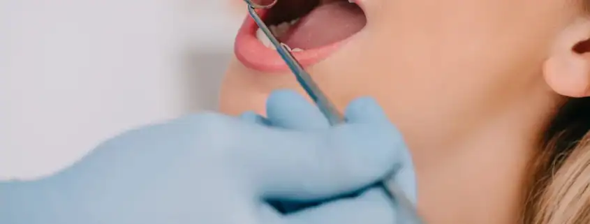 Bulto en el paladar: ¿qué puede ser? 11 Dentista revisando la boca y el paladar de una paciente con un espejo dental